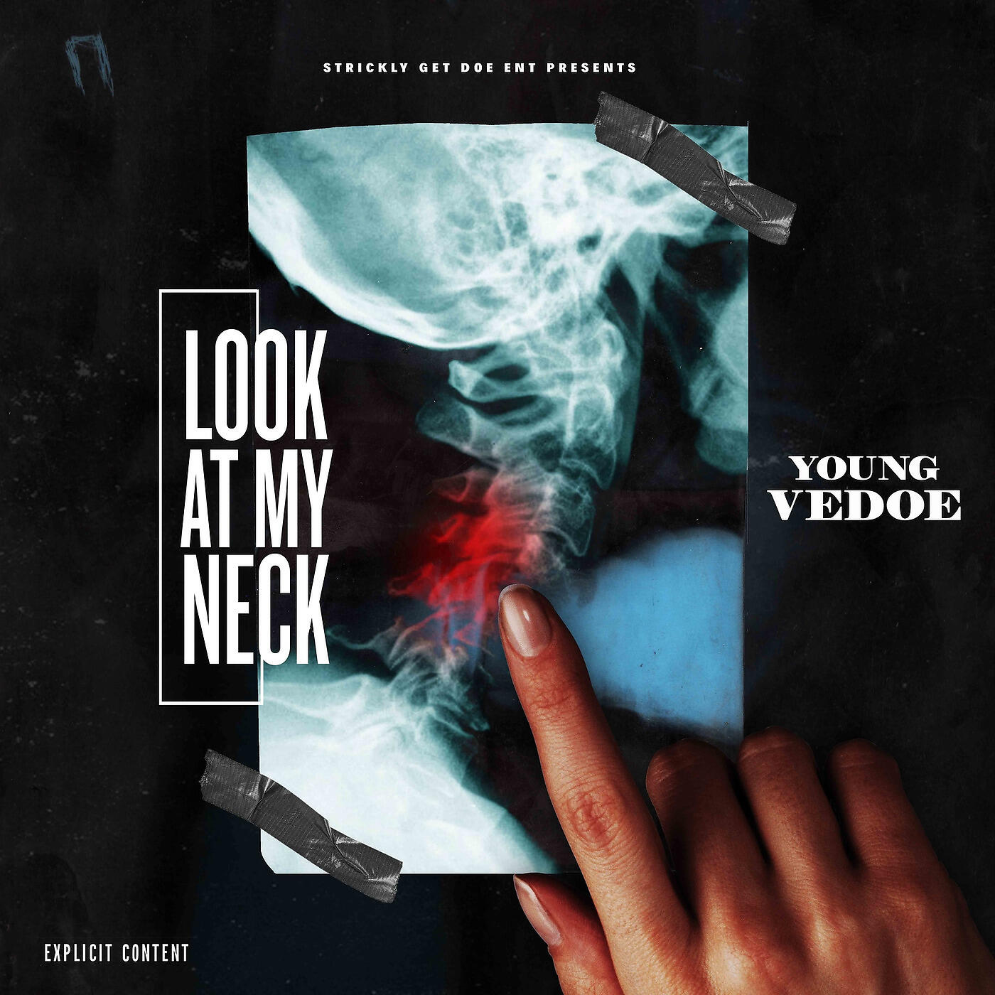 Young Vedoe - Look at My Neck
