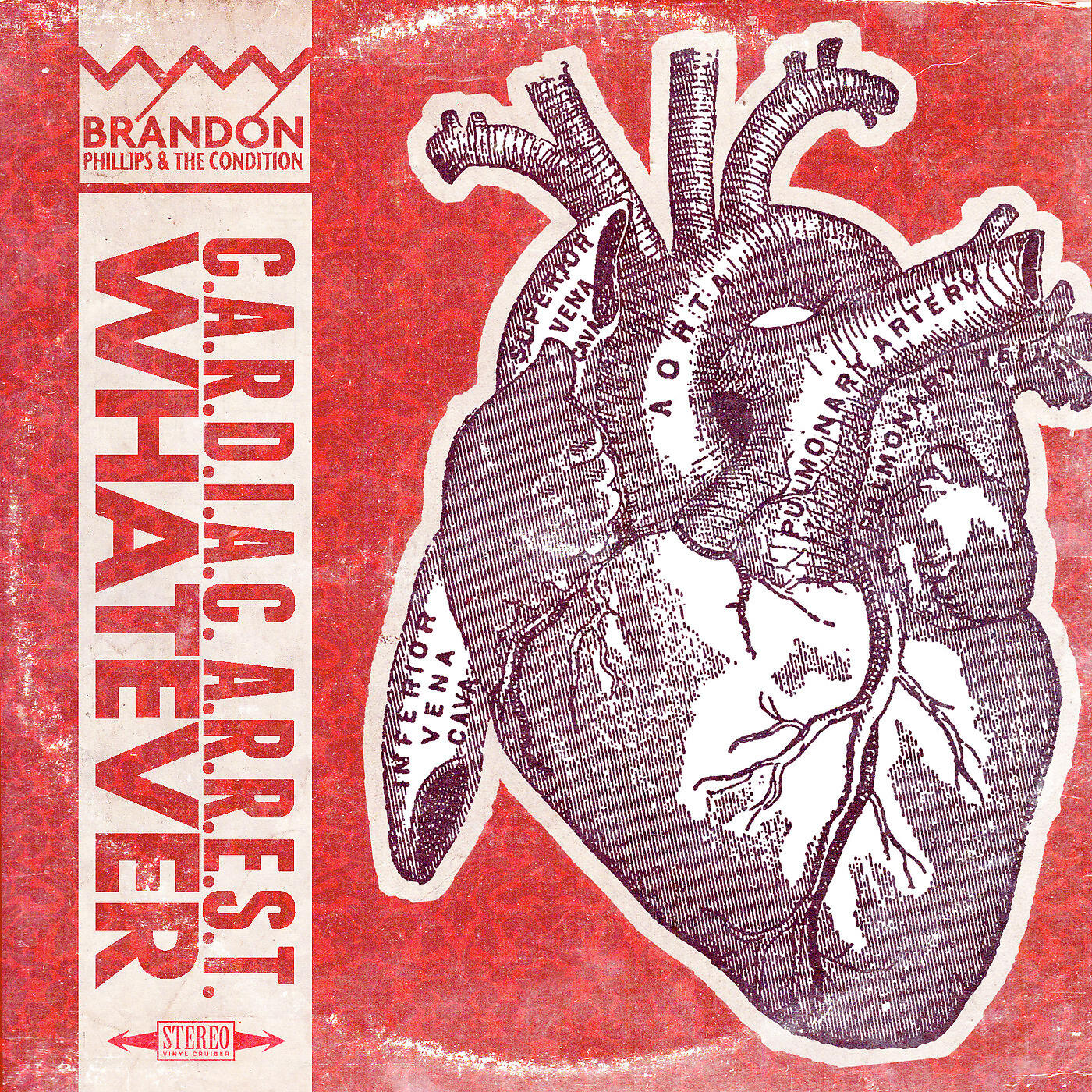 Brandon Phillips and The Condition - C.a.R.D.I.a.C. a.R.R.E.S.T.