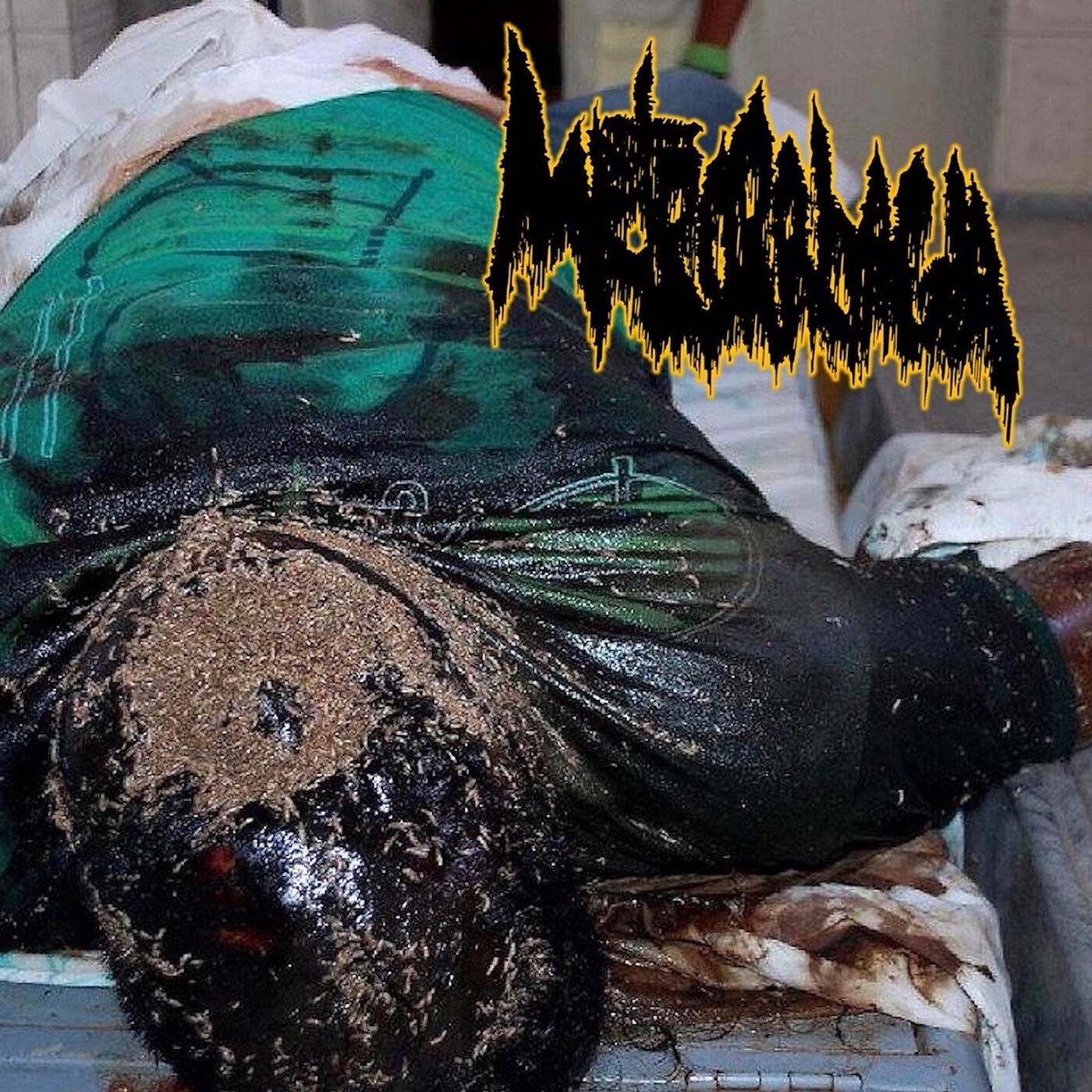 Metrorrhagia - Spontaneous Ejaculation from Fantasies of Cadaver Molesting Deviance