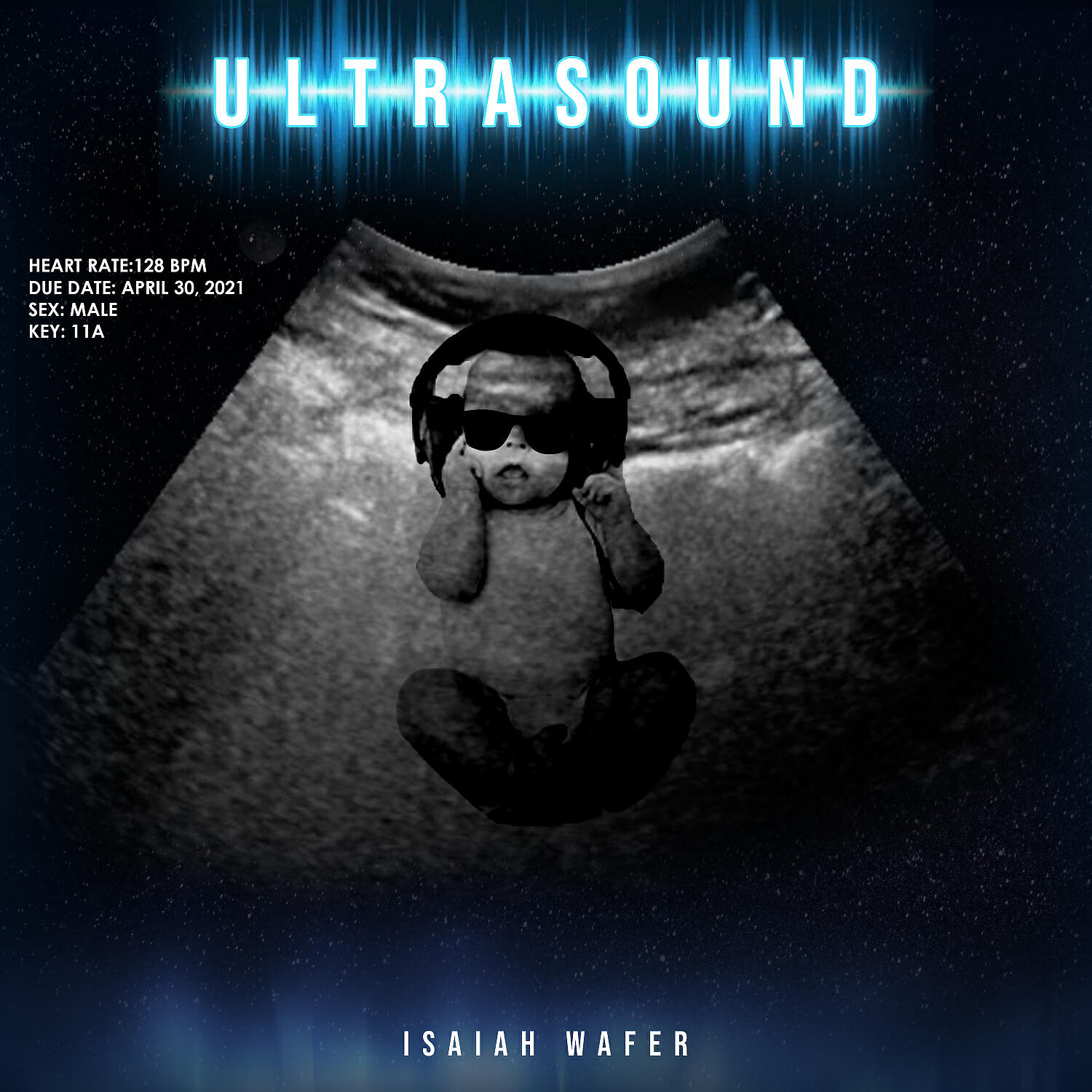 Isaiah Wafer - Ultrasound