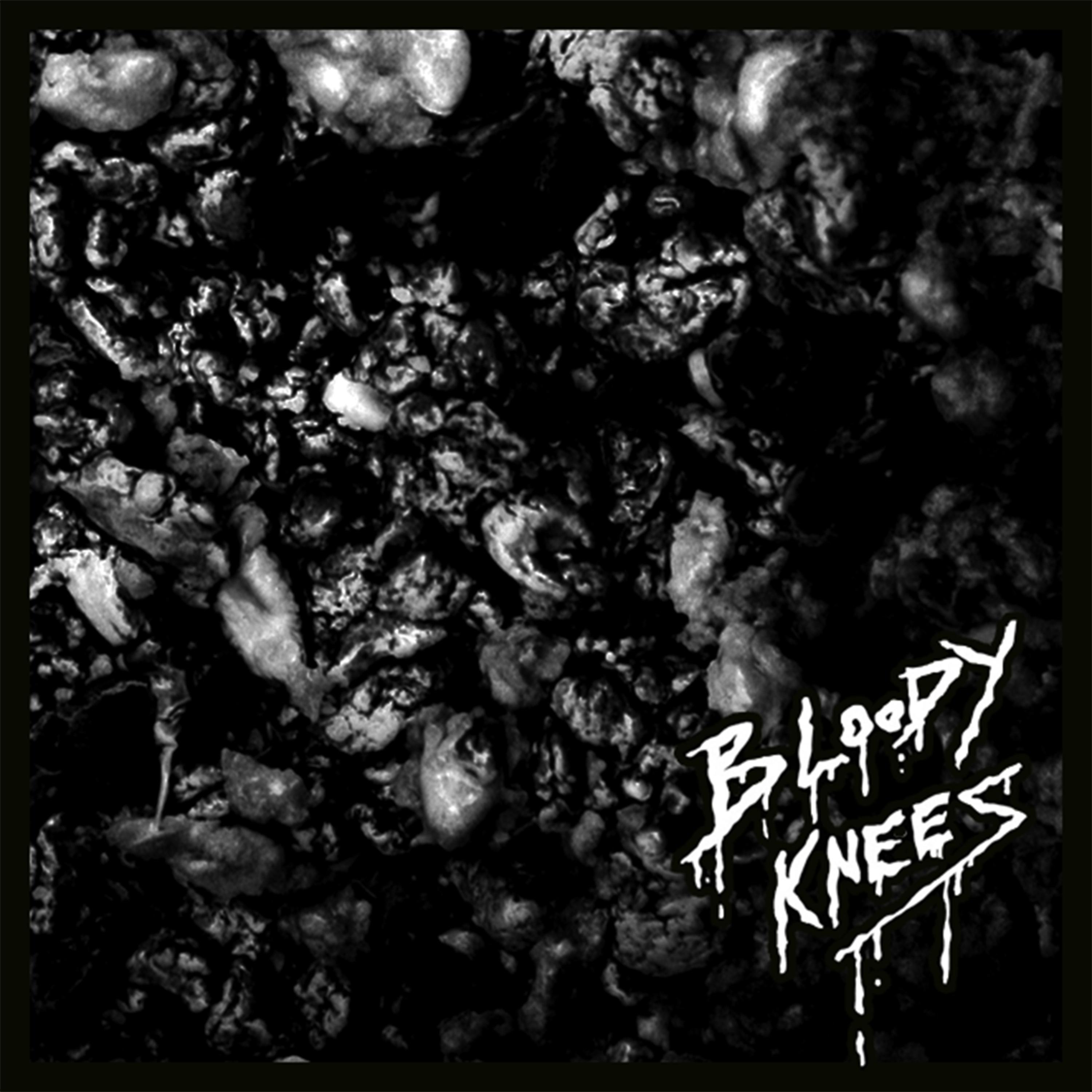 Постер альбома Bloody Knees EP