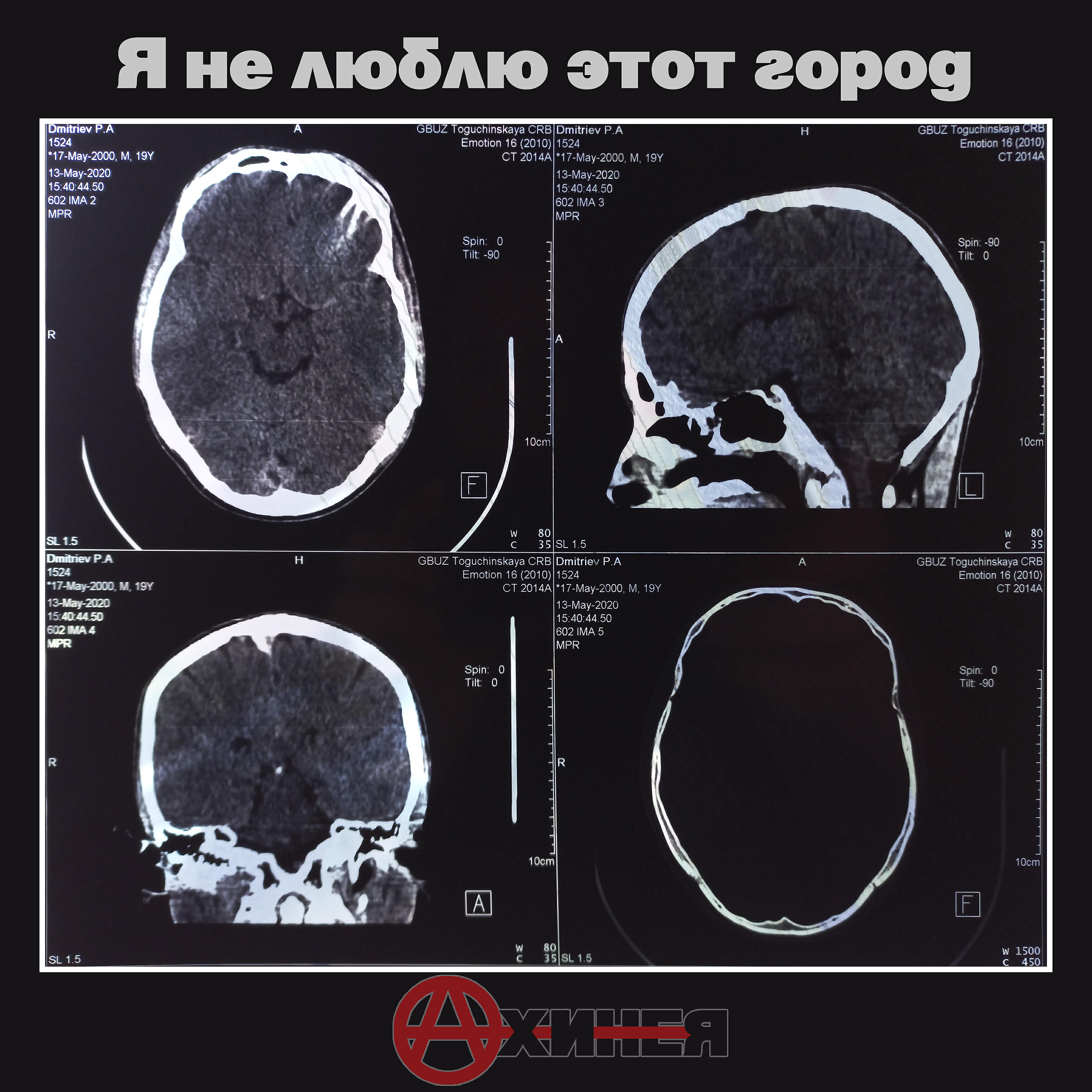 Ахинея - Я не люблю этот город