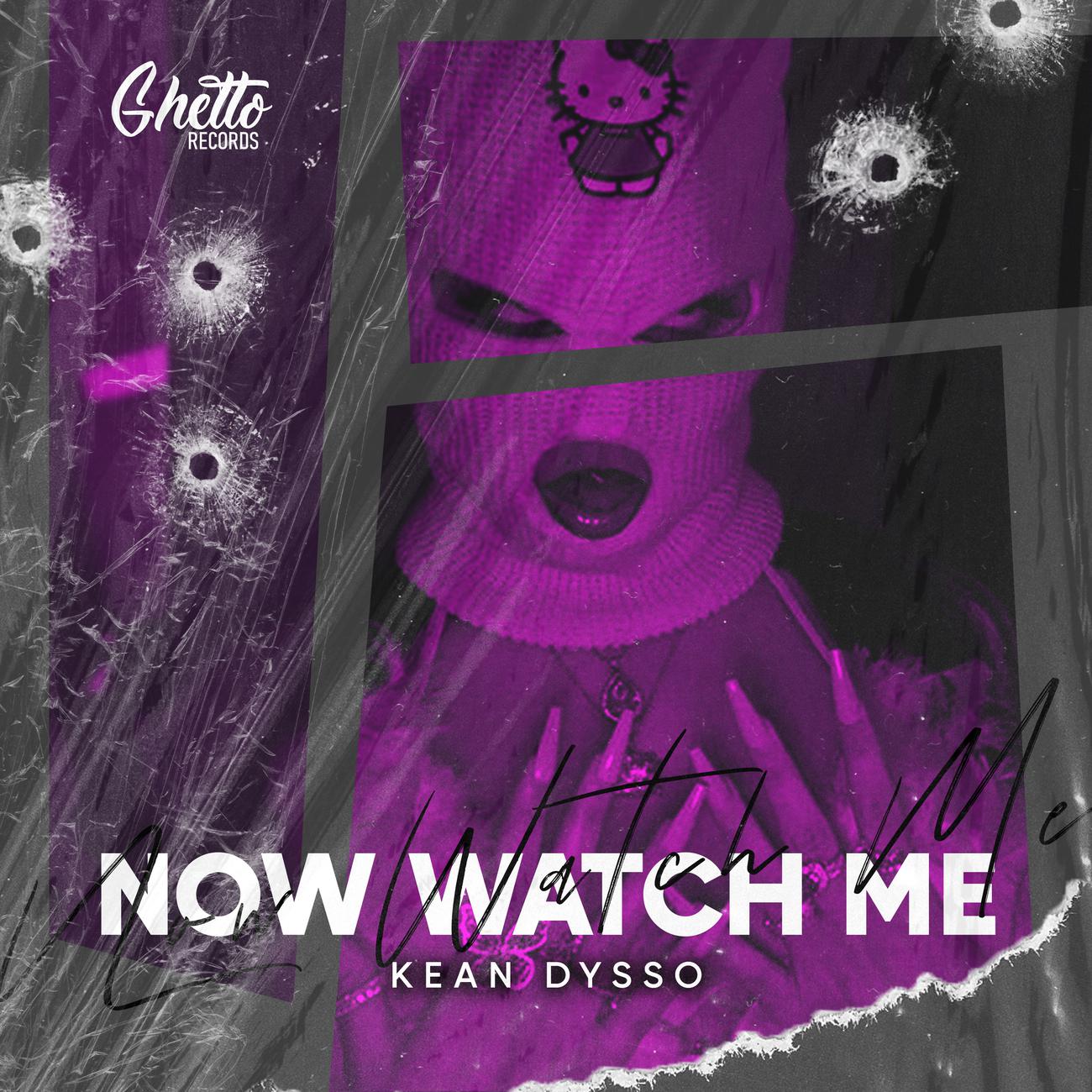 Постер альбома Now Watch ME