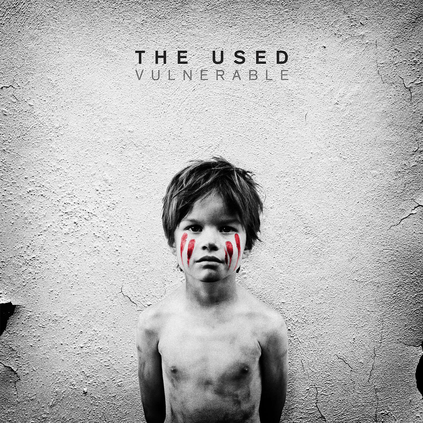 Постер альбома Vulnerable (Deluxe Version)
