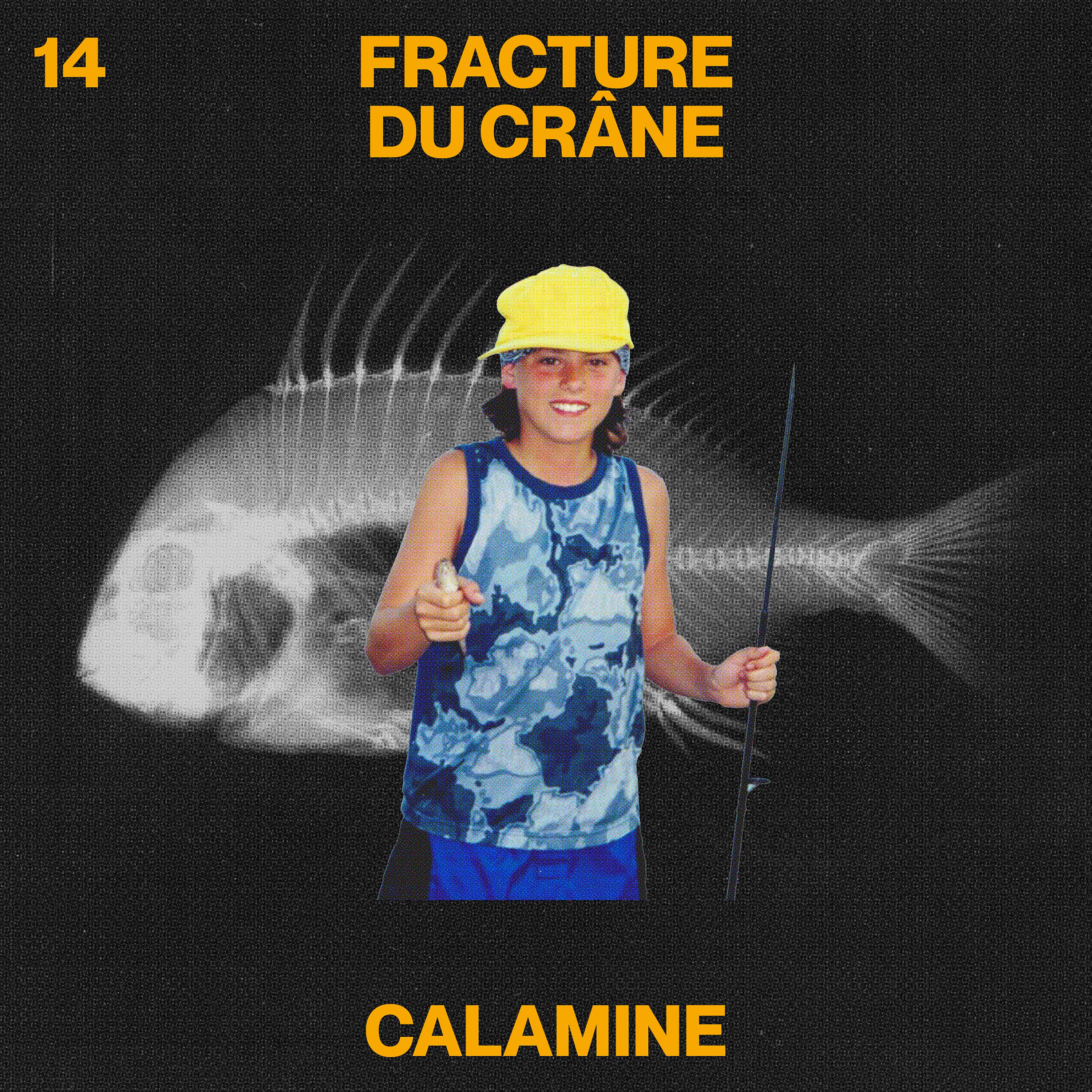 Постер альбома Fracture du crâne