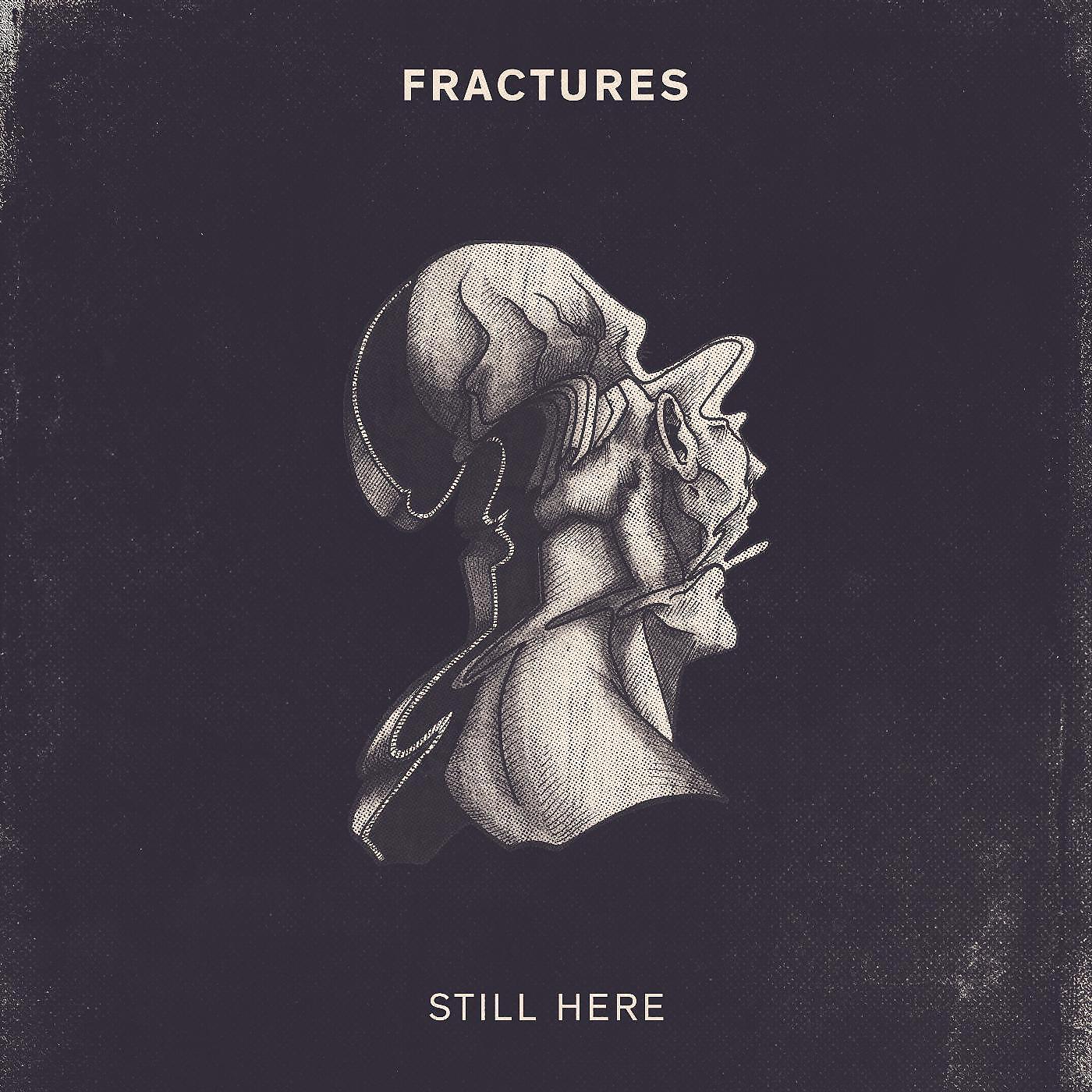 Fractures - Time Frame