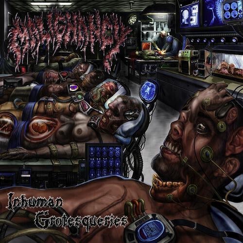 Malignancy - Skeletal Integrity