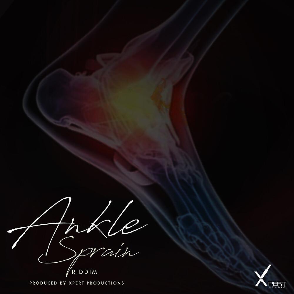 Постер альбома Ankle Sprain Riddim