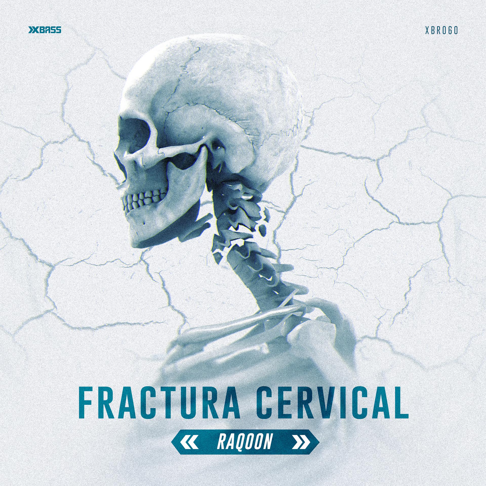 Постер альбома Fractura Cervical (Radio Edit)