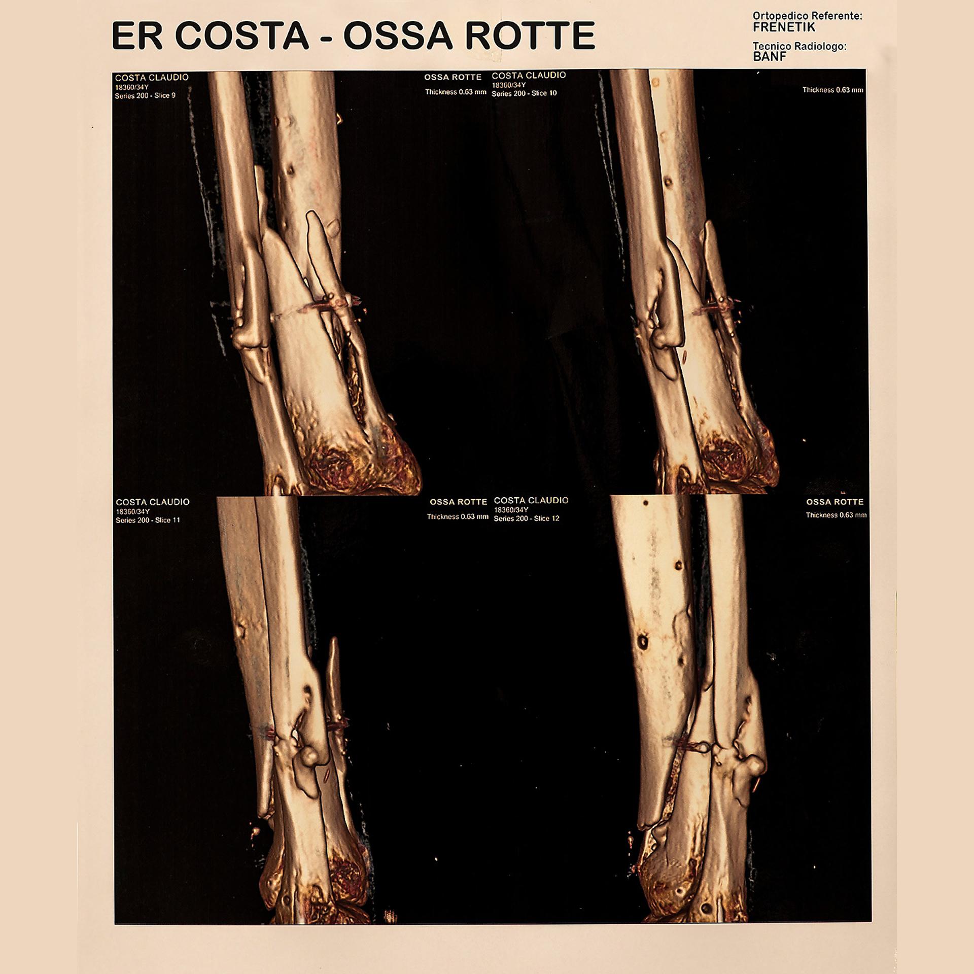 Постер альбома Ossa rotte